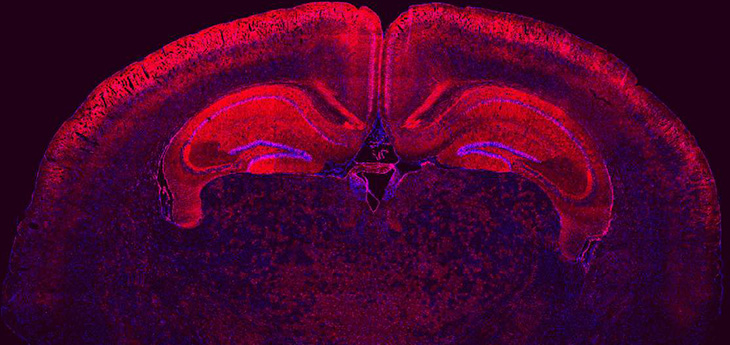 brain section image showing wide distribution of edited cells in the cortex