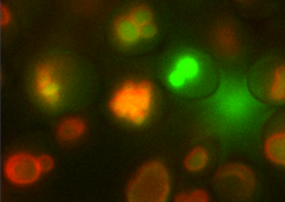 microscope image of osteoyeast cells. The outline of the vacuole is red, the calcium inside the vacuole is green. Image by Berkeley Lab.