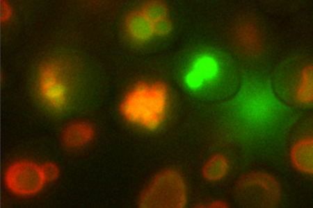 microscope image of osteoyeast cells. The outline of the vacuole is red, the calcium inside the vacuole is green. Image by Berkeley Lab.