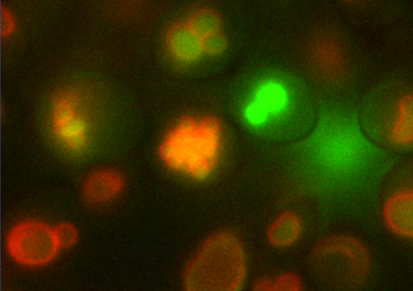 microscope image of osteoyeast cells. The outline of the vacuole is red, the calcium inside the vacuole is green. Image by Berkeley Lab.