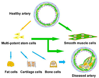Li vascular stem cells