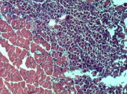 healthy regenerated muscle tissue