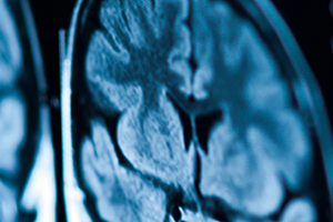 cropped stock photo of brain imaging