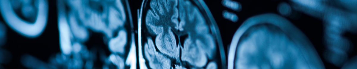 concentration_imaging decorative image of skull MRIs