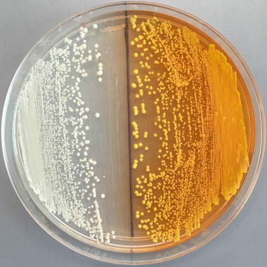 yeast