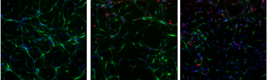 three microscope images of neural stem cells