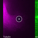 images of microtubules and actin in cells