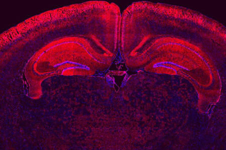 brain section image showing wide distribution of edited cells in the cortex