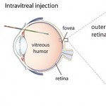 retina virus diagram